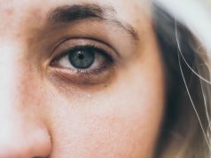 ¿Cuáles son los efectos del estrés en el rostro? Descúbrelo aquí